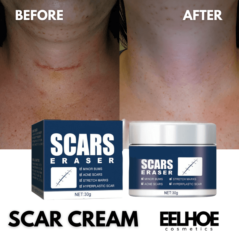 EELHOE Scar Erase Cream product shot